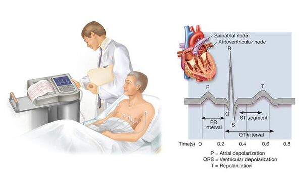 Elektrokardiografija za odkrivanje bolezni srca in ožilja pri hipertenziji